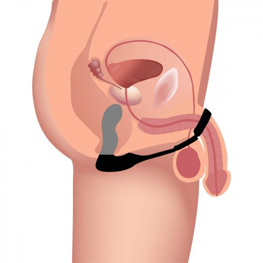 Swell 10X Inflatable and Vibrating Prostate Plug with Cock and Ball Ring (In stock June 23rd)